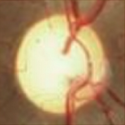Neuro-Ophthalmology