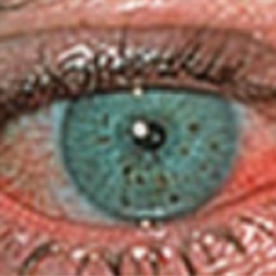 Comprehensive Clinical Ophthalmology